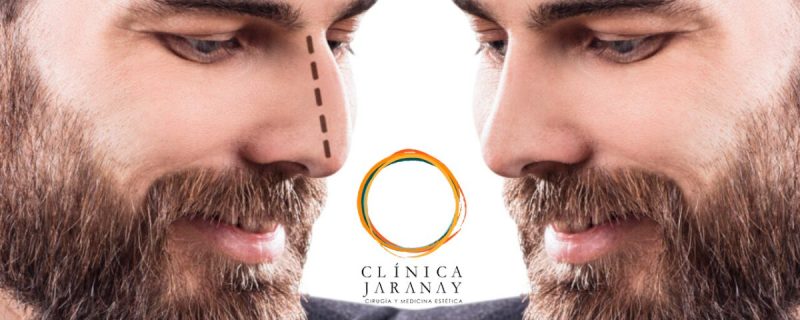 Diferencias-entre-la-rinoplastia-masculina-y-femenina-Clinica-Jaranay-1200x480